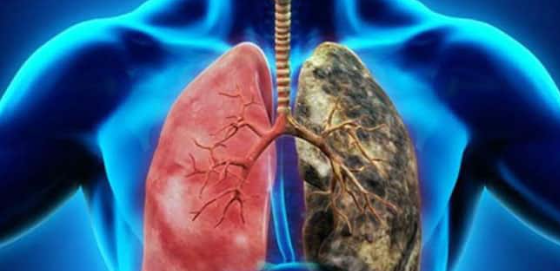 Akciğer Kanseri’ne Çok Etkili