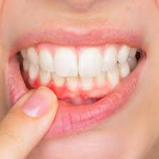 Düğün sırasında köpek aniden gelinin elini ısırdı: