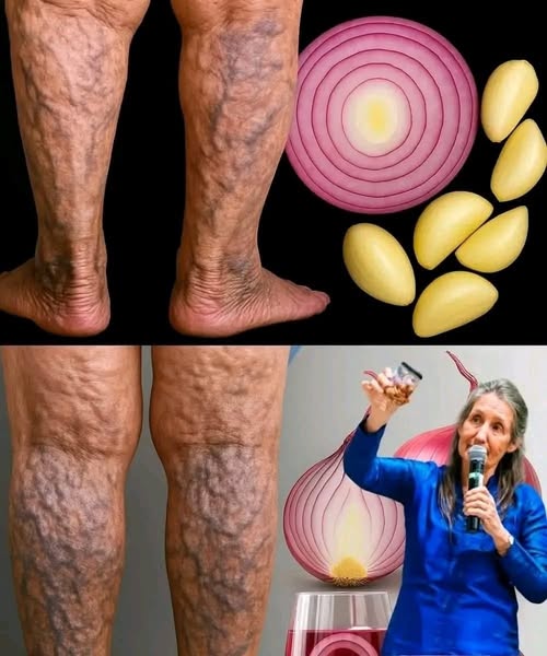 Varislere Veda Etkili Şekilde Sarımsak