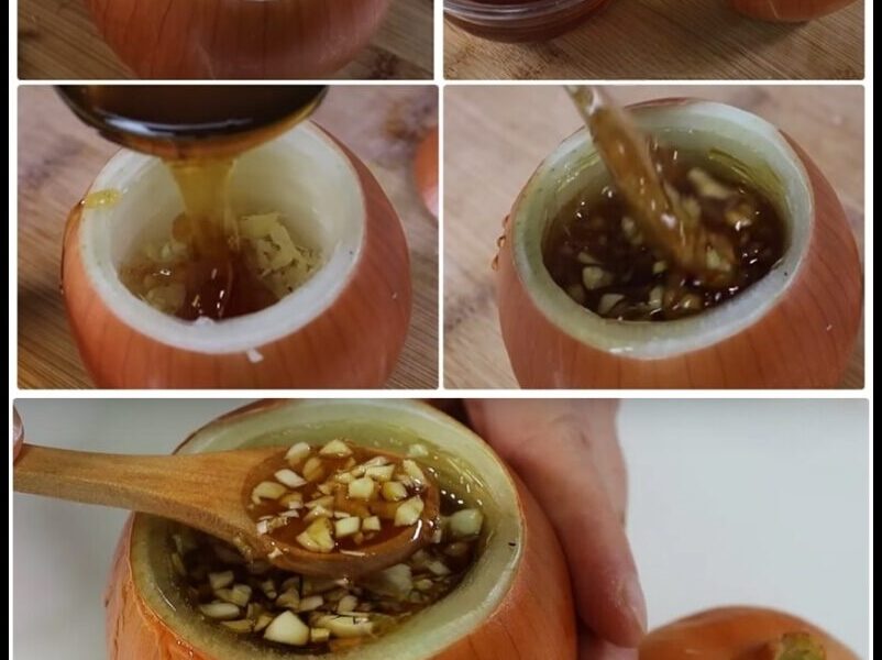 Öksürügü Bıcak Gibi Keser Balgam Soktürücü