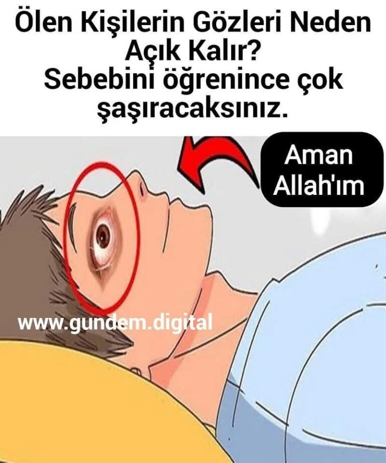 Ölen Kişilerin Gözleri Neden Açık Kalır