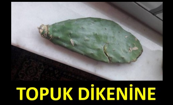 Topuk Dikeni Rahatsızlığı