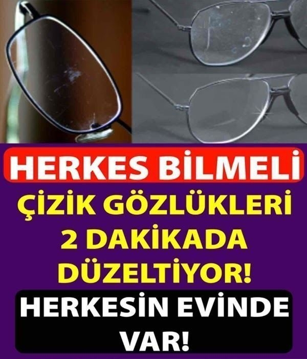Çizik Gözlükleriniz varsa