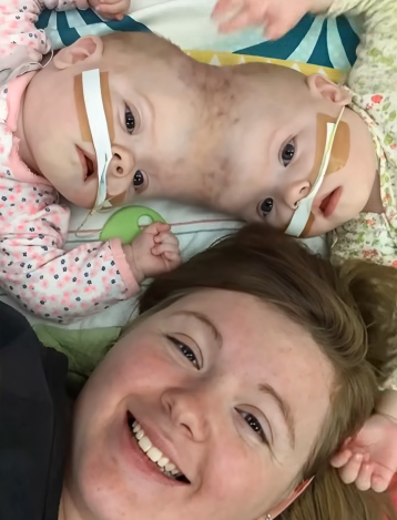 Doğumda hayatta kalma şansı sadece