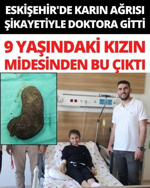 karın ağrısı şikayetiyle doktora gitti