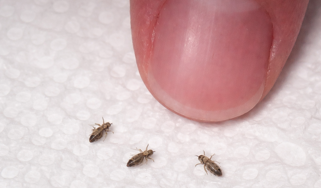 Eşim bunu küçük çocuğumuzun saçında buldu