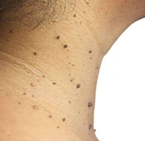 tarifle benlerden kurtul