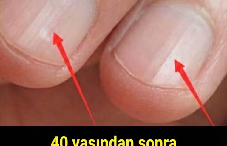 40 yaşından sonra tırnaklarınızda