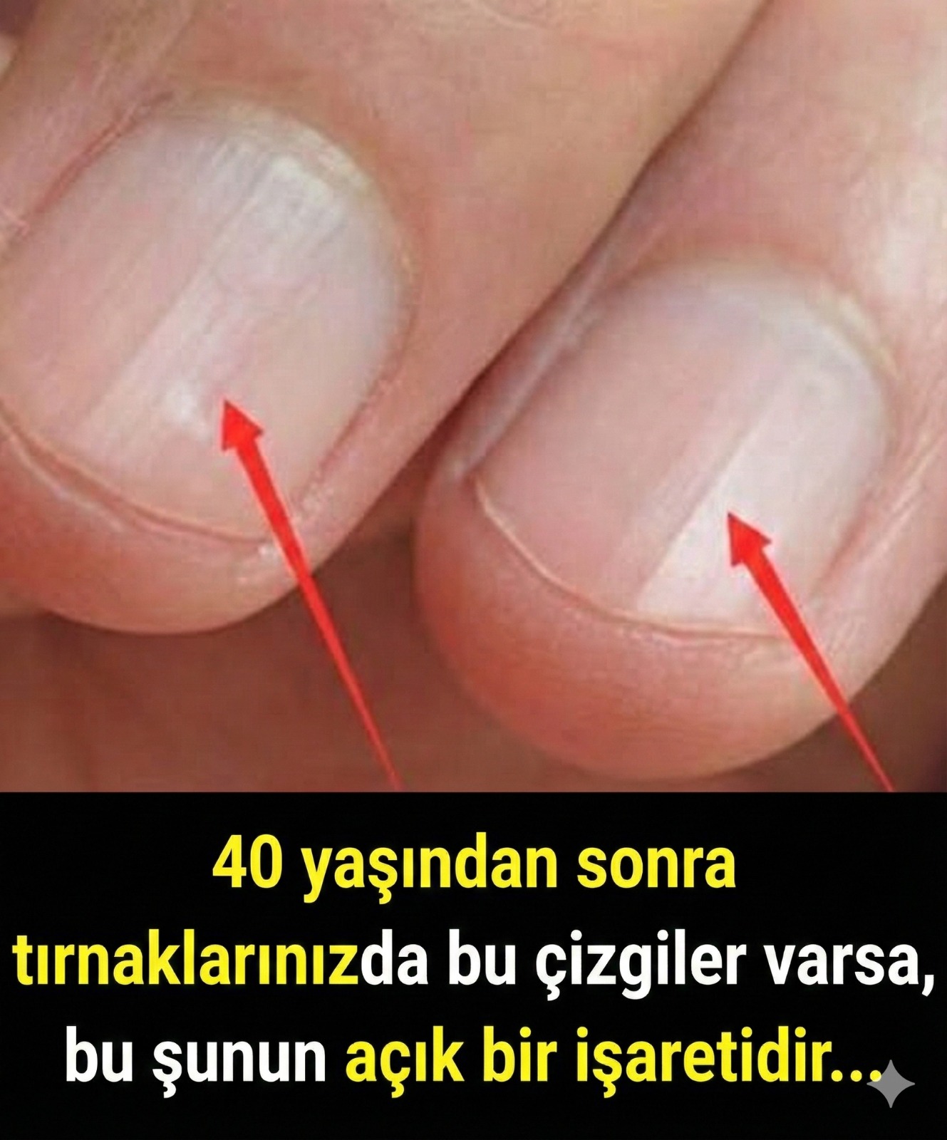 40 yaşından sonra tırnaklarınızda
