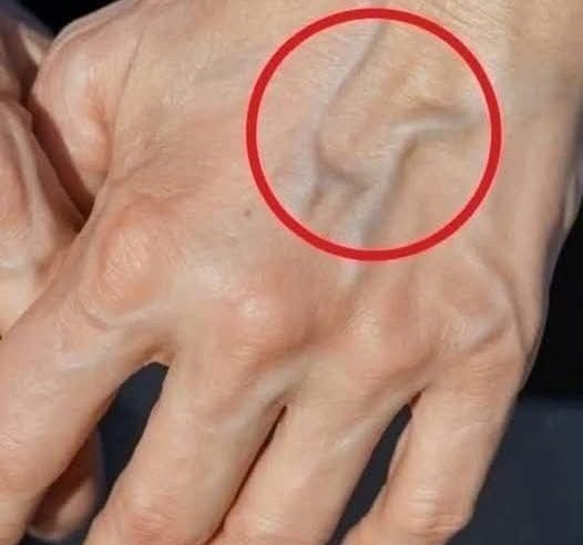 Görünür damarların varsa öylesin