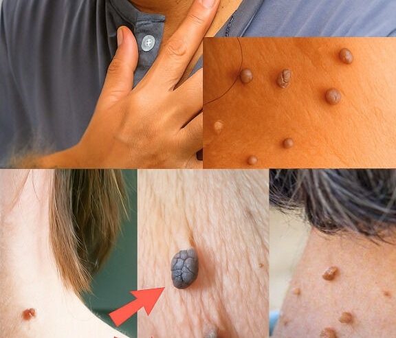 Görünür Damarlar Ne Anlama Gelir