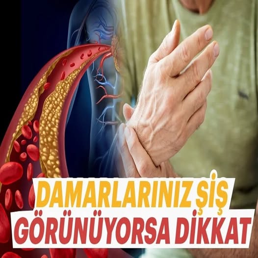 Görünür damarların varsa dikkat