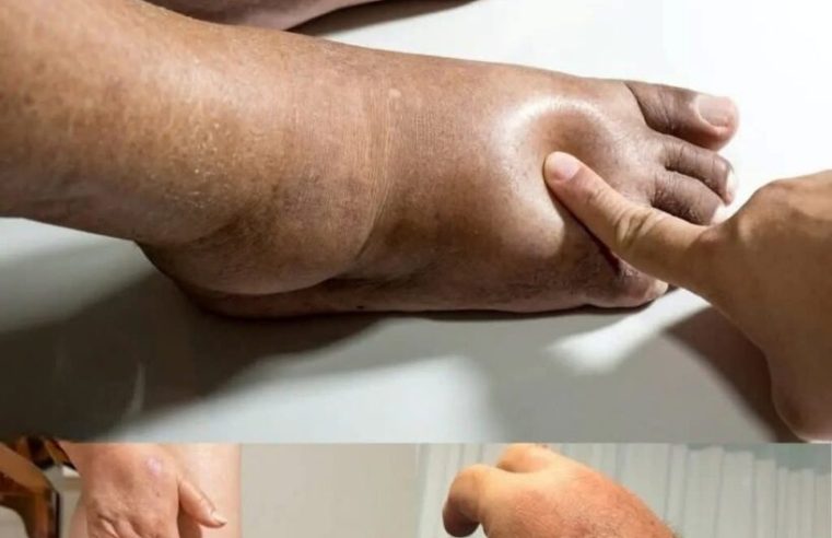 Ellerin ya da ayakların şişiyor mu