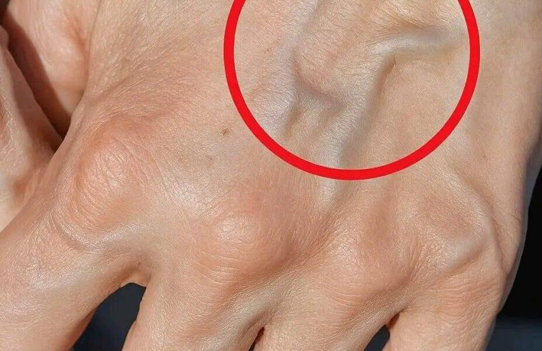 Görünür damarlarınız varsa