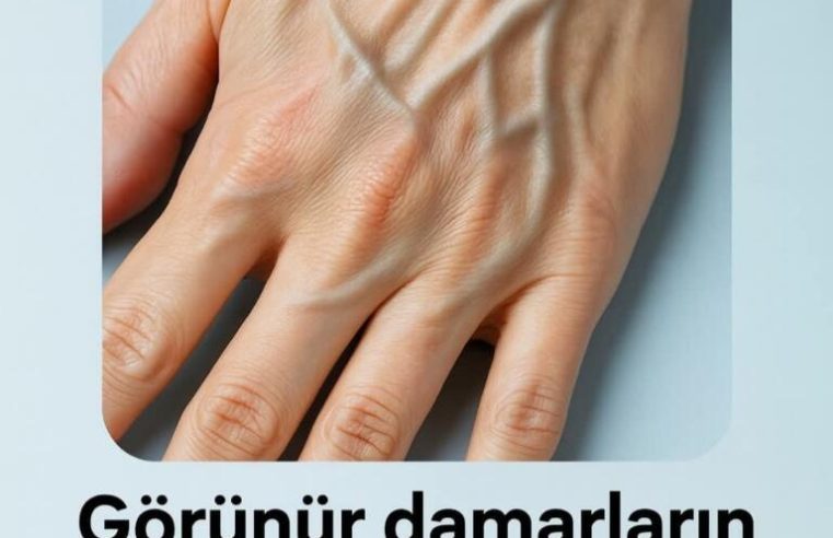 Görünür damarların varsa öylesin demektir